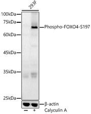 Phospho-FOXO4-S197 Rabbit pAb