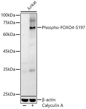 Phospho-FOXO4-S197 Rabbit pAb