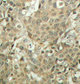 Phospho-CFL1-S3 Rabbit pAb