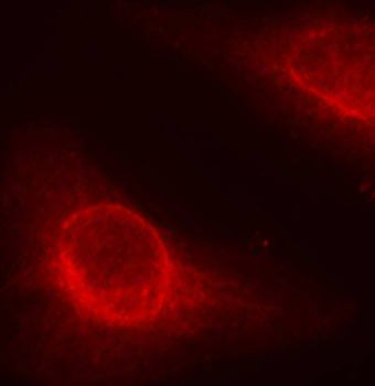 Phospho-CFL1-S3 Rabbit pAb