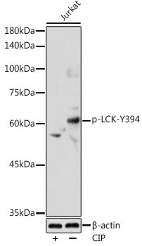 Phospho-LCK-Y394 Rabbit pAb