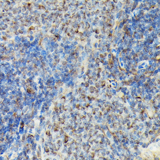Phospho-VASP-S239 Rabbit pAb