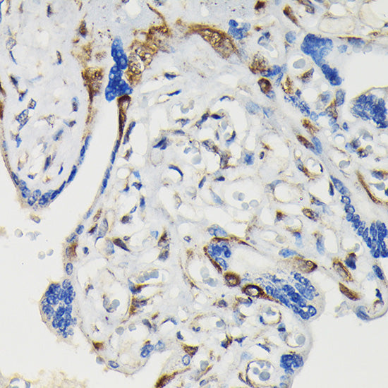 Phospho-VASP-S239 Rabbit pAb