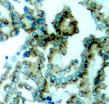 Phospho-PKCalpha/beta II-T638/641 Rabbit pAb