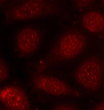 Phospho-PKCalpha/beta II-T638/641 Rabbit pAb