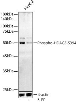 Phospho-HDAC2-S394 Rabbit pAb