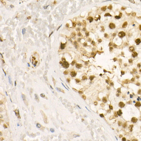 Phospho-HDAC2-S394 Rabbit pAb