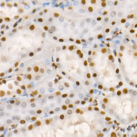 Phospho-HDAC2-S394 Rabbit pAb