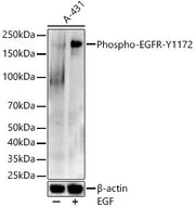 Phospho-EGFR-Y1172 Rabbit pAb