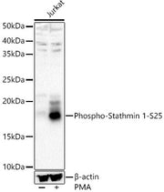 Phospho-Stathmin 1-S25 Rabbit pAb