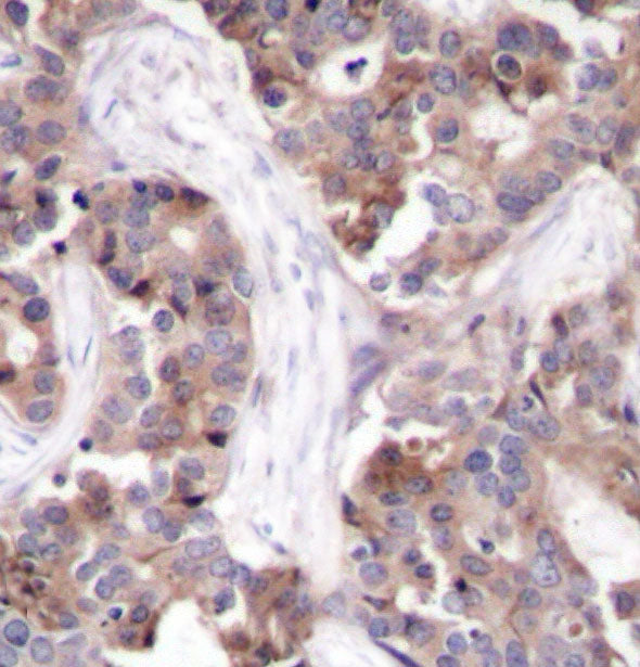 Phospho-Stathmin 1-S25 Rabbit pAb