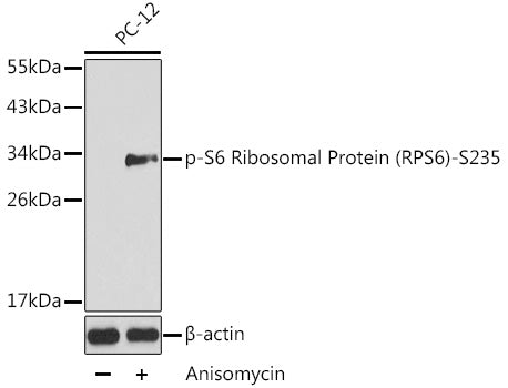 Phospho-S6 Ribosomal Protein (RPS6)-S235 Rabbit pAb