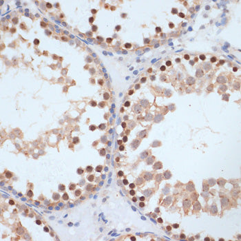 Phospho-BRCA1-S1423 Rabbit pAb