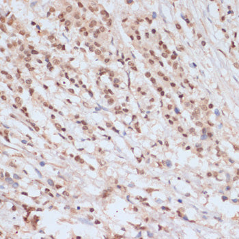 Phospho-BRCA1-S1423 Rabbit pAb