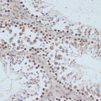 Phospho-BRCA1-S1423 Rabbit pAb