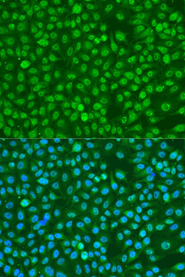 Phospho-BRCA1-S1423 Rabbit pAb