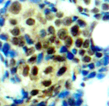 Phospho-ERK1-T202 + ERK2-T185 Rabbit pAb