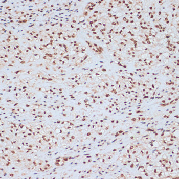 Phospho-ERK1-Y204 Rabbit pAb
