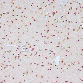 Phospho-ERK1-Y204 Rabbit pAb