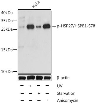 Phospho-HSP27/HSPB1-S78 Rabbit pAb