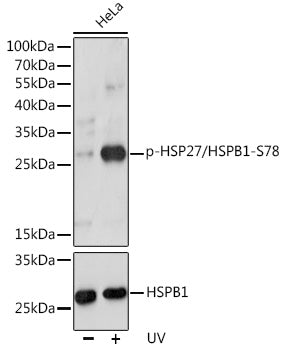 Phospho-HSP27/HSPB1-S78 Rabbit pAb