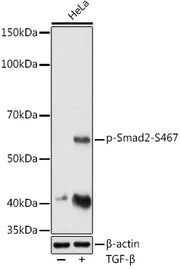 Phospho-Smad2-S467 Rabbit pAb