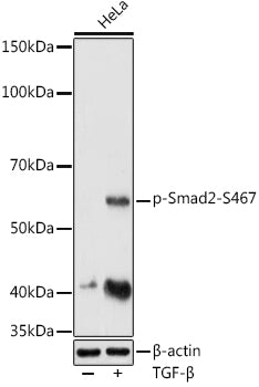 Phospho-Smad2-S467 Rabbit pAb