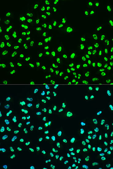 Phospho-BRCA1-S988 Rabbit pAb
