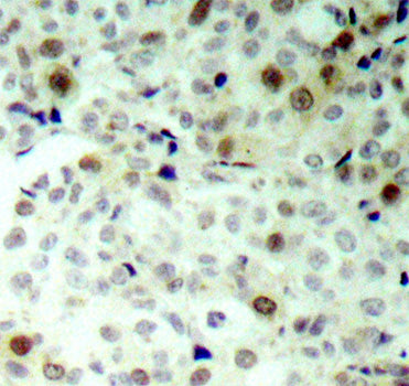Phospho-CDK2-T160 Rabbit pAb