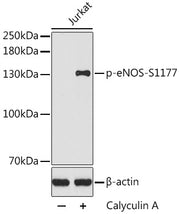 Phospho-eNOS-S1177 Rabbit pAb