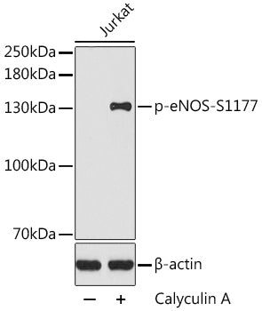 Phospho-eNOS-S1177 Rabbit pAb