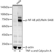 Phospho-NF-kB p65/RelA-S468 Rabbit pAb