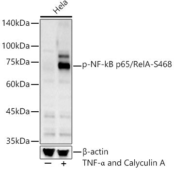 Phospho-NF-kB p65/RelA-S468 Rabbit pAb