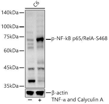 Phospho-NF-kB p65/RelA-S468 Rabbit pAb
