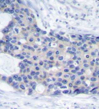 Phospho-ZAP70-Y493 Rabbit pAb