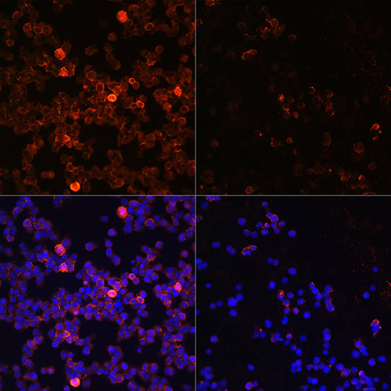 Phospho-ZAP70-Y493 Rabbit pAb