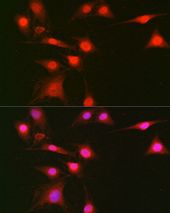 Phospho-ERK1-T202/Y204 + ERK2-T185/Y187 Rabbit pAb