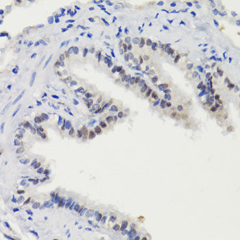 Phospho-STAT3-S727 Rabbit pAb