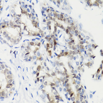 Phospho-STAT3-S727 Rabbit pAb