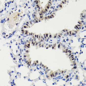 Phospho-STAT3-S727 Rabbit pAb