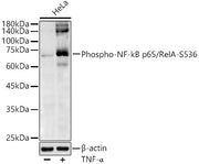 Phospho-NF-kB p65/RelA-S536 Rabbit pAb