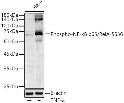Phospho-NF-kB p65/RelA-S536 Rabbit pAb