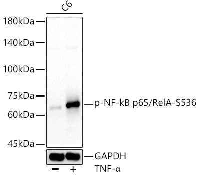 Phospho-NF-kB p65/RelA-S536 Rabbit pAb