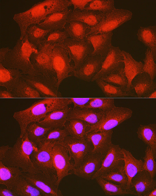 Phospho-PDK1/PDPK1-S241 Rabbit pAb