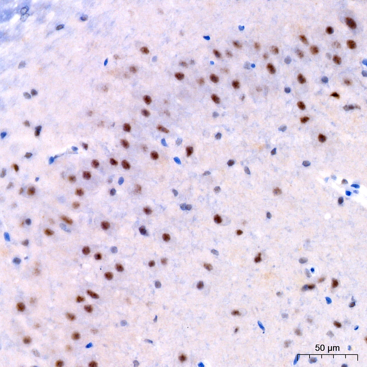 Phospho-ERK1-T202 + ERK2-T185 Rabbit mAb