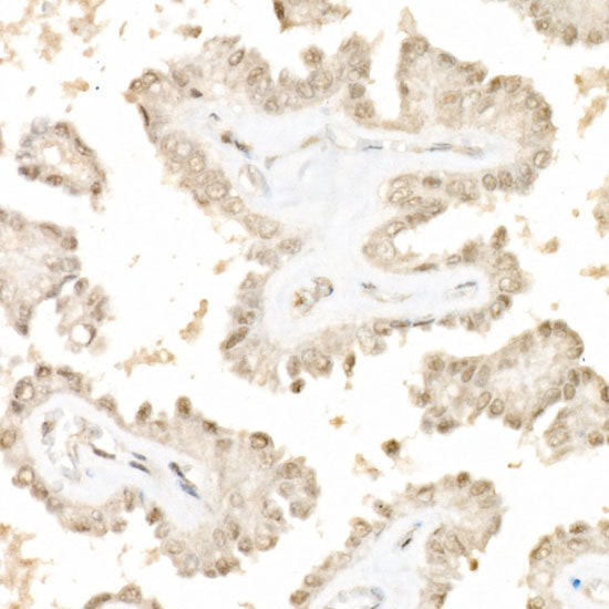 Phospho-YAP1-S127 Rabbit pAb