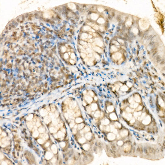 Phospho-YAP1-S127 Rabbit pAb