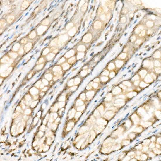 Phospho-YAP1-S127 Rabbit pAb