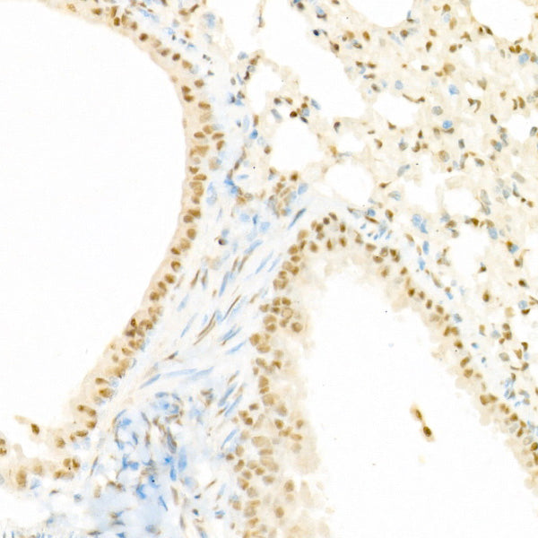 Phospho-Raf1-S338 Rabbit pAb