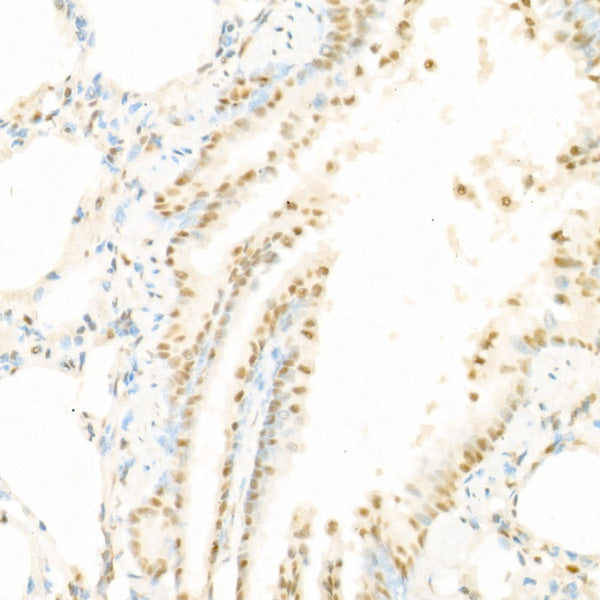 Phospho-Raf1-S338 Rabbit pAb